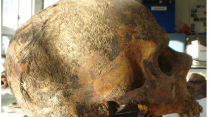 Cráneo con restos de cabello, Tesis doctoral de Jesús Manuel Pereza Casajús https://repositorio.uam.es/handle/10486/5232